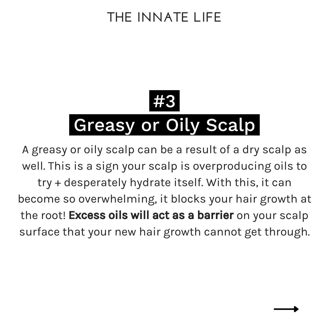 Charcoal Scalp Detox Kopfhautpflege The Innate Life - Genuine Selection