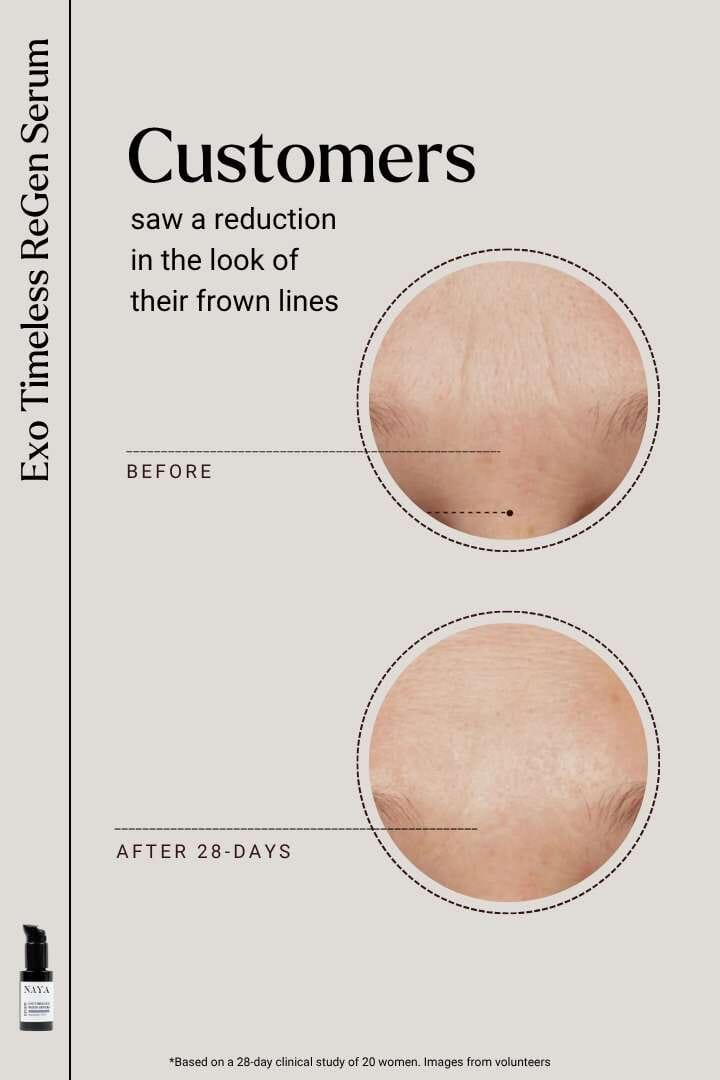 EXOSOMES | Exo Timeless ReGen Serum Serum Naya - Genuine Selection