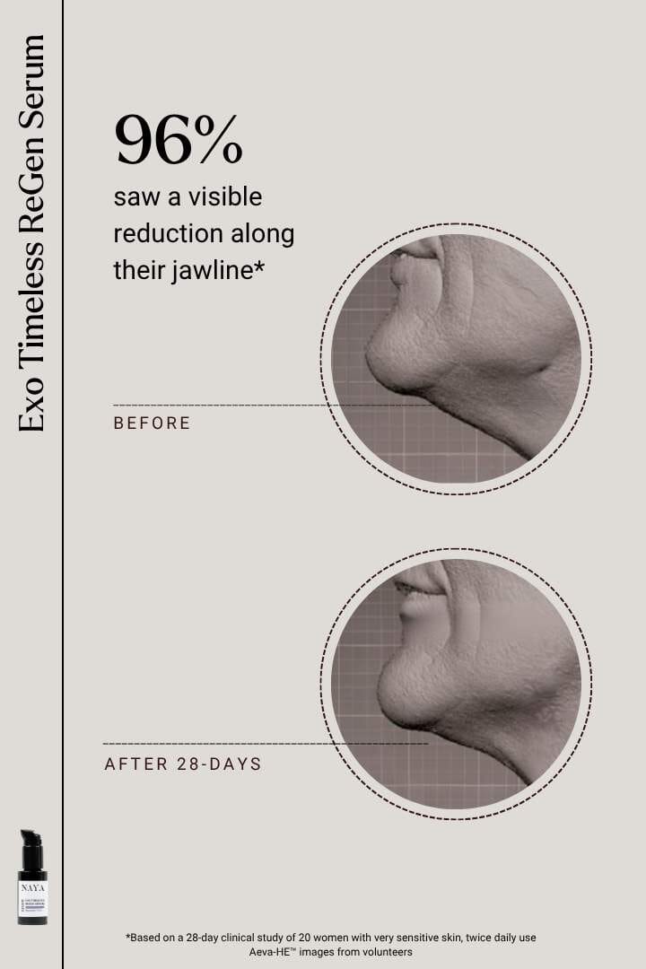 EXOSOMES | Exo Timeless ReGen Serum Serum Naya - Genuine Selection