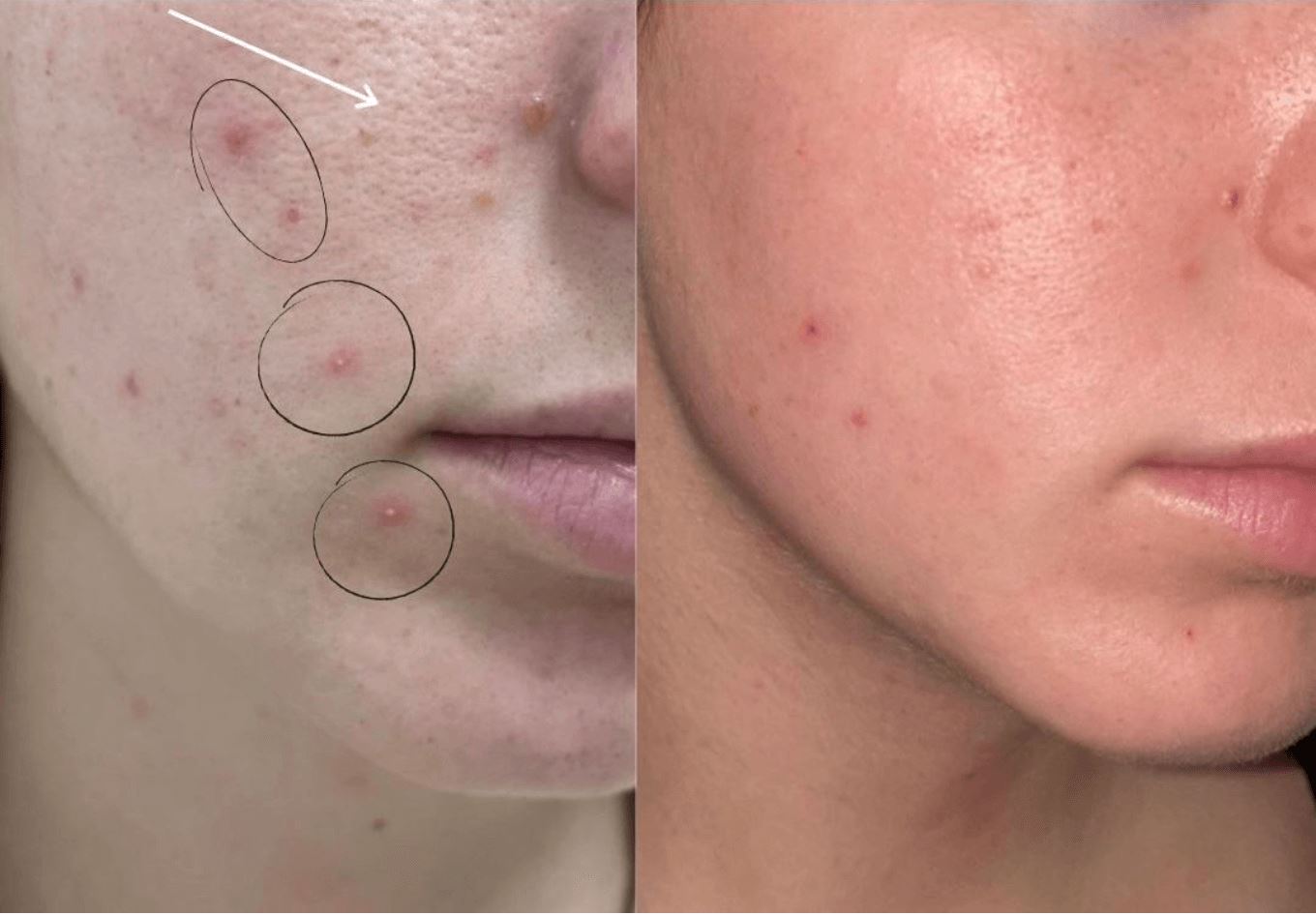 CLEAR Treatment & Repair Serum Serum Dafna's Personal Skincare - Genuine Selection